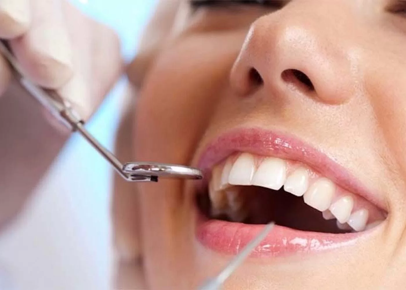 a guide to finding the right cosmetic dentist
