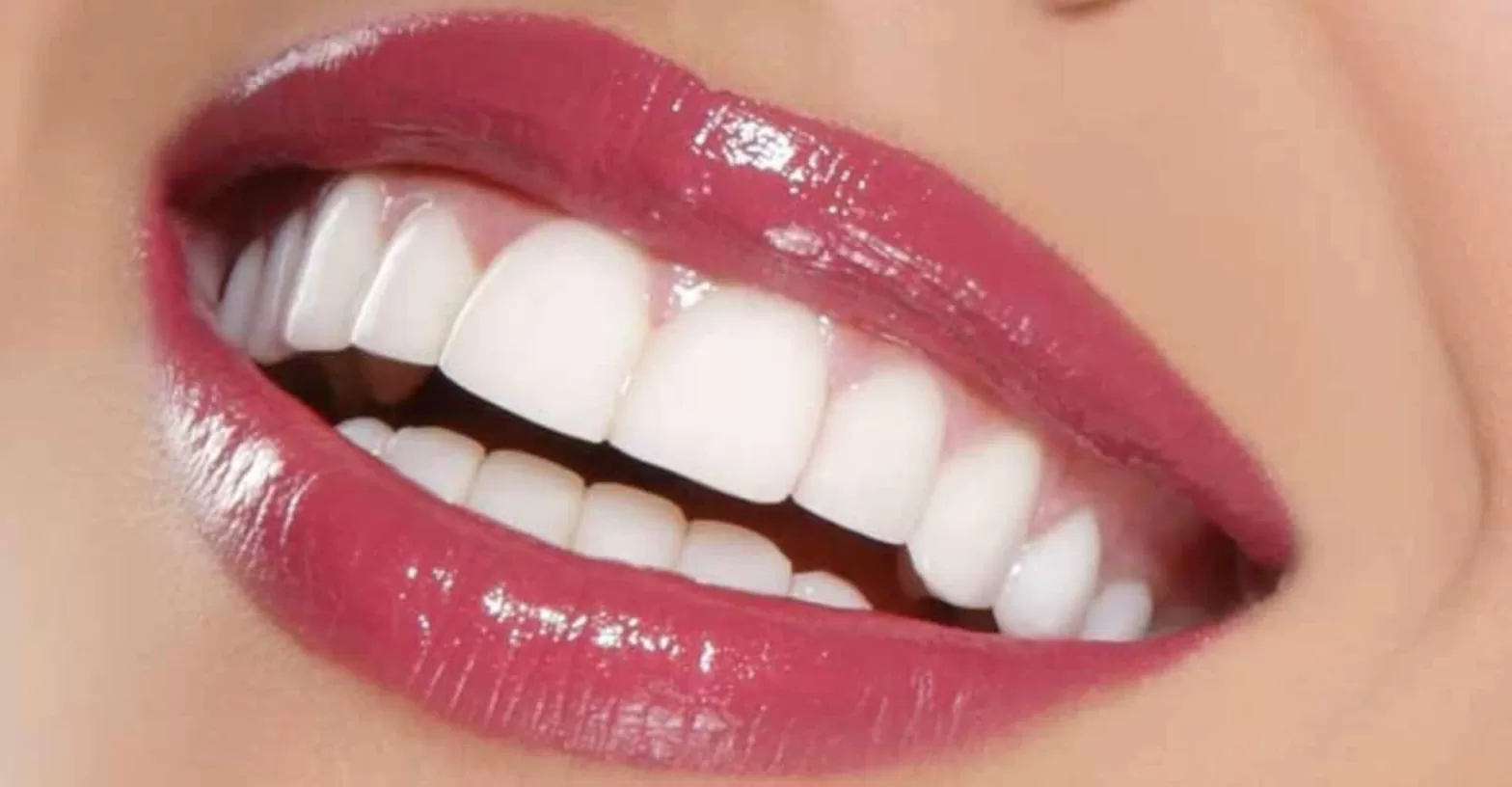 clinic effect the ultimate destination for hollywood smile dental treatment 1
