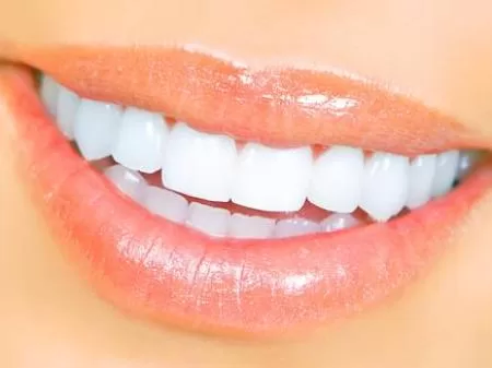 discover the benefits of a perfect smile in istanbul