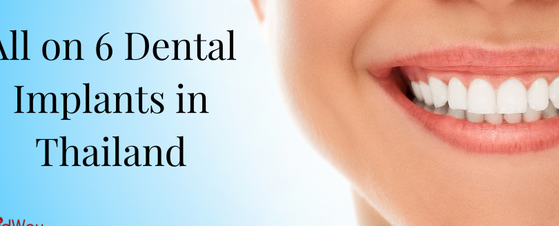 exploring the benefits of getting a dental implant in turkey