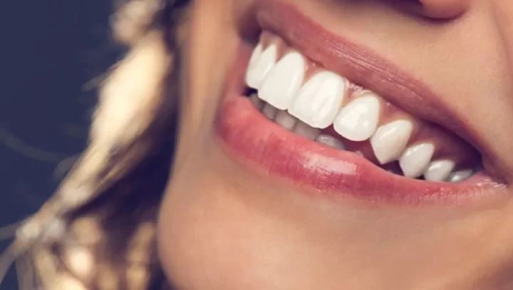 the benefits of whiter brighter teeth how to get a hollywood smile in turkey
