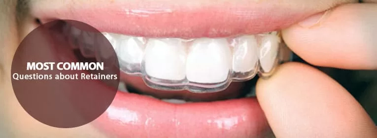 the importance of wearing your dental retainers