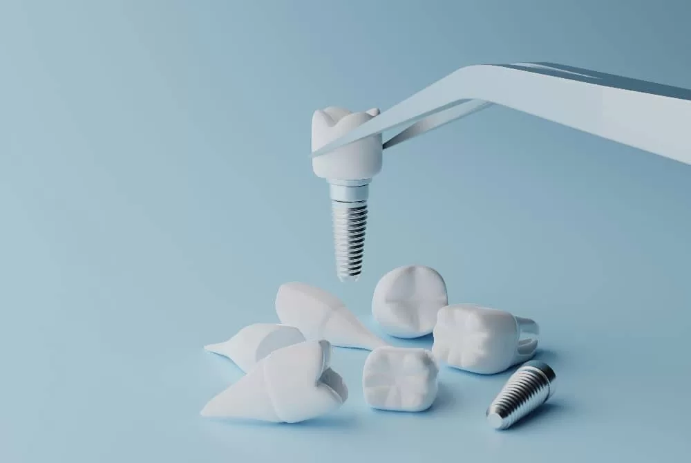 unveiling the benefits of opting for a dental implant in turkey